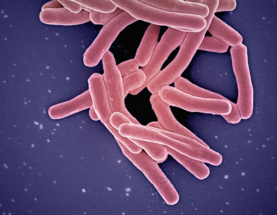 tuberculosis Mycobacterium Tuberculosis Bacteria, the Cause of TB Scanning electron micrograph of Mycobacterium tuberculosis particles (colorized pink), the bacterium which causes TB. Credit: NIAID https://www.flickr.com/photos/niaid/52765697672/ 