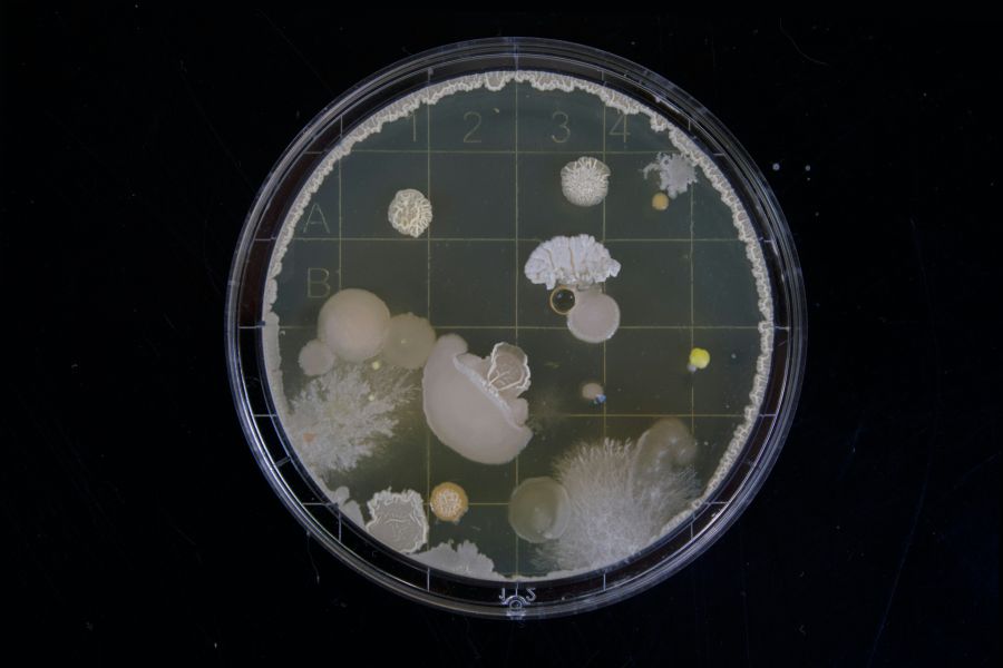 Science A friend of mine had to do some bacteria samples during her bachelor thesis. When i saw those i was instantly fascinated by the vast range of variation within this tiny microcosm. 