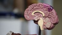 Dementia Alzheimer  brain,medical,health