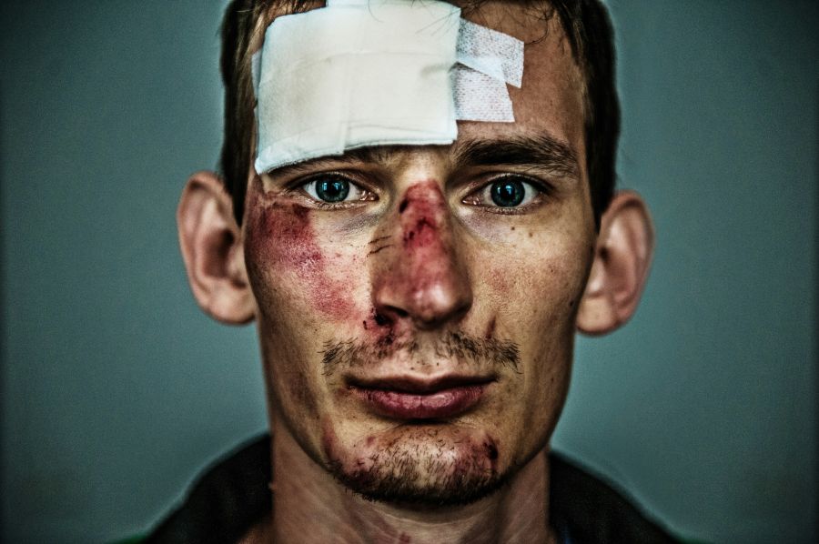 violence injury Portait of man after his bike accident. 