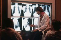 Radiology Healthcare Radiologist Discusses Chest X-rays
 