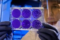 Bacteria Scientist examines the result of a plaque assay, which is a test that allows scientists to count how many flu virus particles (virions) are in a mixture. To perform the test, scientists must first grow host cells that attach to the bottom of the plate, and then add viruses to each well so that the attached cells may be infected. After staining the uninfected cells purple, the scientist can count the clear spots on the plate, each representing a single virus particle. science,medical,virus