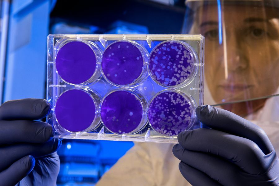 Bacteria Scientist examines the result of a plaque assay, which is a test that allows scientists to count how many flu virus particles (virions) are in a mixture. To perform the test, scientists must first grow host cells that attach to the bottom of the plate, and then add viruses to each well so that the attached cells may be infected. After staining the uninfected cells purple, the scientist can count the clear spots on the plate, each representing a single virus particle. science,medical,virus